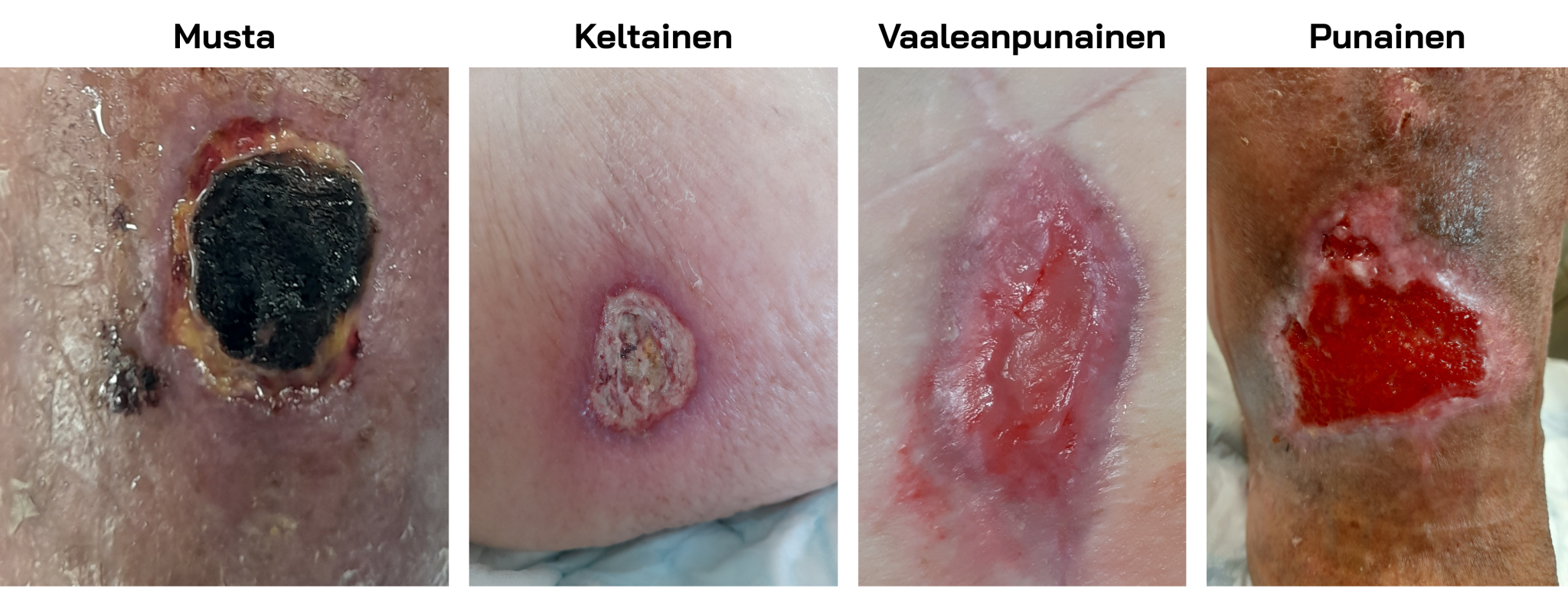 Eri näköisiä haavoja.